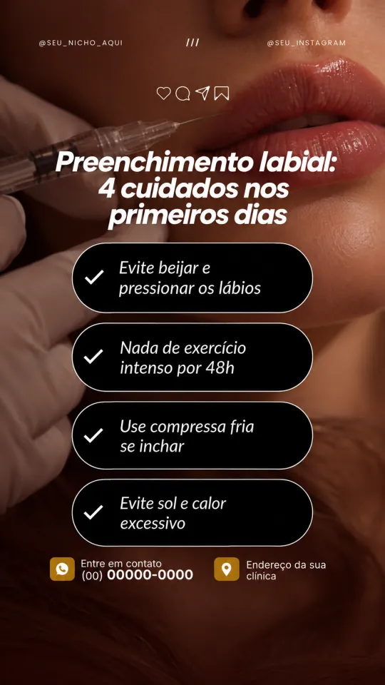 Reel: Preenchimento labial: 4 cuidados nos primeiros dias