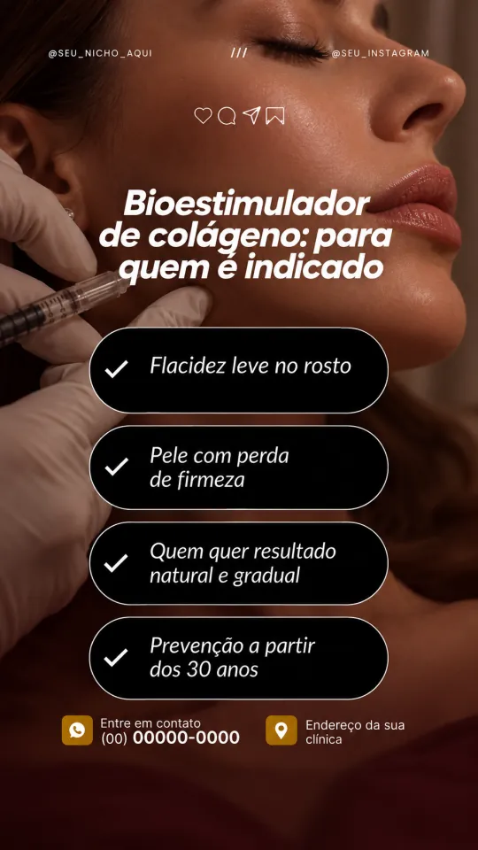 Reel: Bioestimulador de colágeno: para quem é indicado
